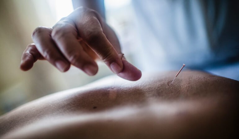 close-up-of-hand-holding-fine-needle-performing-a-2026-01-09-10-39-43-utc-2
